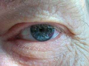 La degeneracion macular es una enfermedad de los ojos